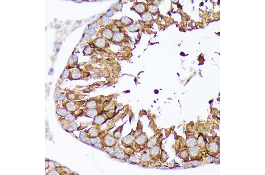 Immunohistochemistry - Anti-Nectin 2 Antibody (A308952) - Antibodies.com