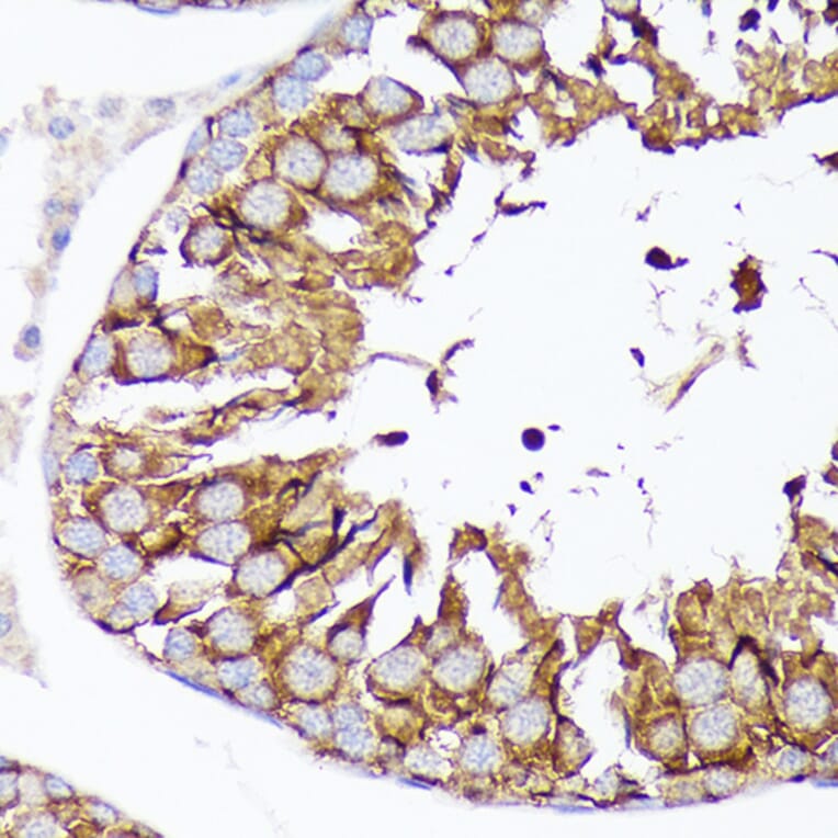 Immunohistochemistry - Anti-Nectin 2 Antibody (A308952) - Antibodies.com