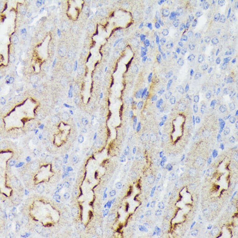 Immunohistochemistry - Anti-Nectin 2 Antibody (A308952) - Antibodies.com