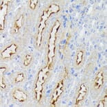 Immunohistochemistry - Anti-Nectin 2 Antibody (A308952) - Antibodies.com