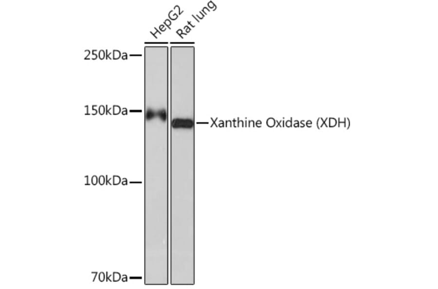 Western Blot - Anti-Xanthine Oxidase Antibody [ARC1385] (A308953) - Antibodies.com