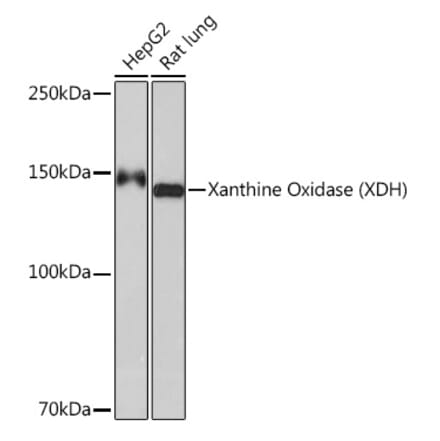 Western Blot - Anti-Xanthine Oxidase Antibody [ARC1385] (A308953) - Antibodies.com