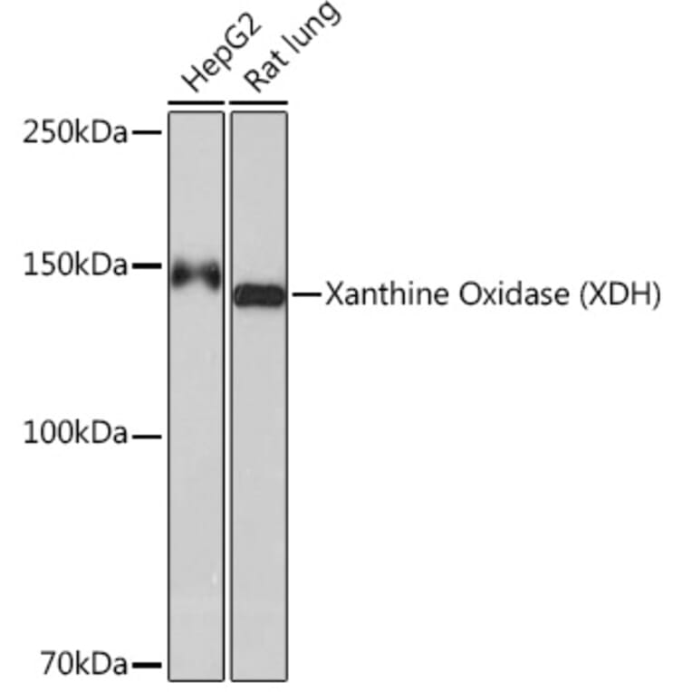 Western Blot - Anti-Xanthine Oxidase Antibody [ARC1385] (A308953) - Antibodies.com