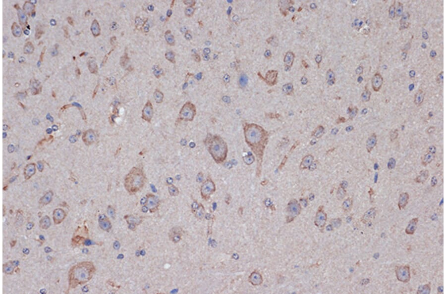 Immunohistochemistry - Anti-Xanthine Oxidase Antibody [ARC1385] (A308953) - Antibodies.com