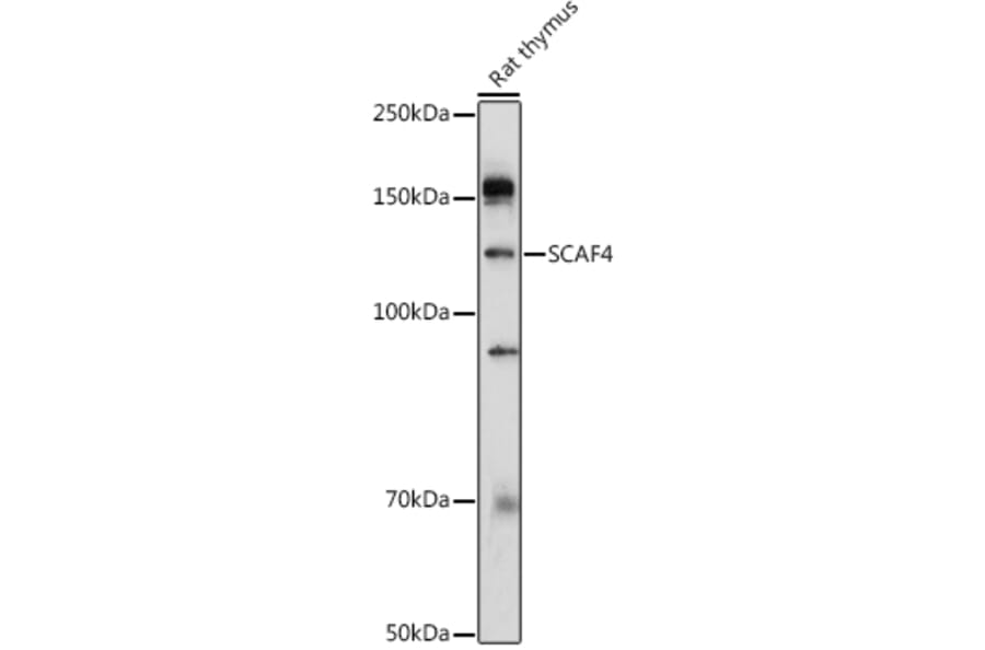 Western Blot - Anti-SCAF4 Antibody (A308954) - Antibodies.com