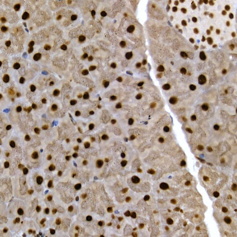 Immunohistochemistry - Anti-SCAF4 Antibody (A308954) - Antibodies.com