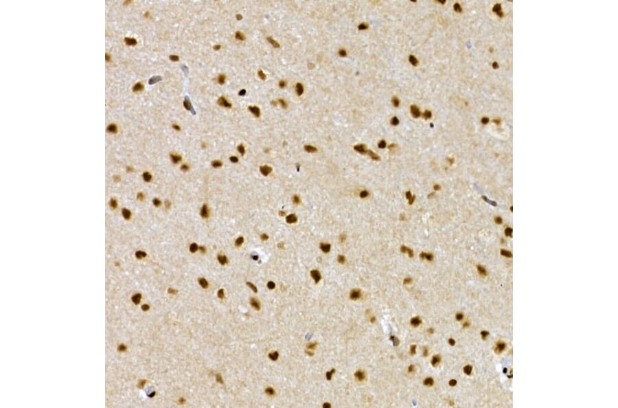 Immunohistochemistry - Anti-SCAF4 Antibody (A308954) - Antibodies.com