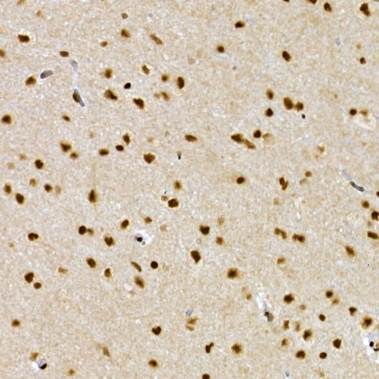 Immunohistochemistry - Anti-SCAF4 Antibody (A308954) - Antibodies.com