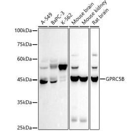 Western Blot - Anti-GPCR GPRC5B Antibody [ARC2932] (A308955) - Antibodies.com