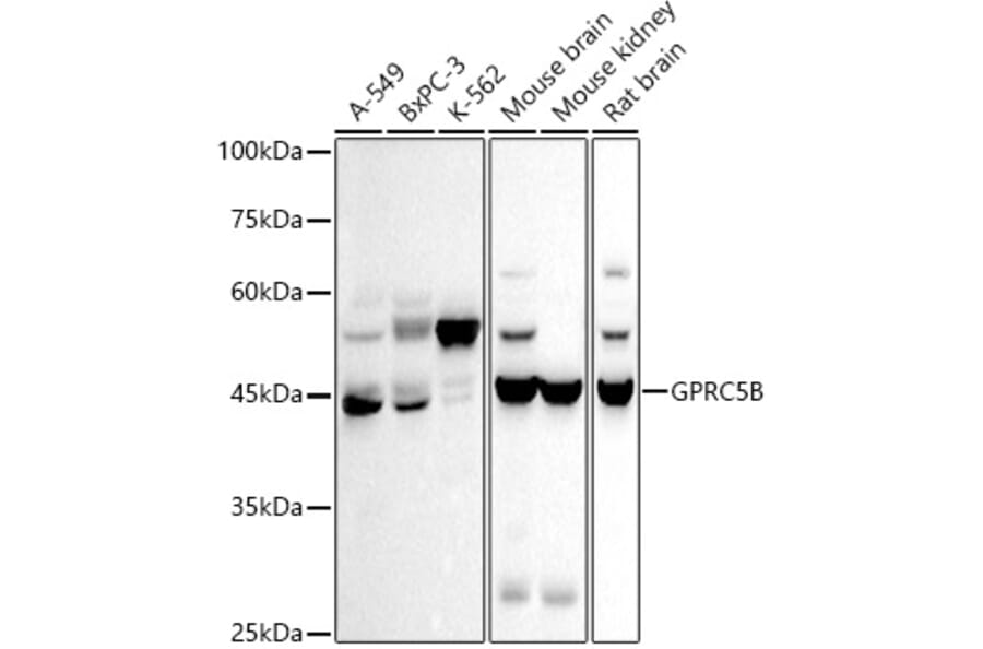 Western Blot - Anti-GPCR GPRC5B Antibody [ARC2932] (A308955) - Antibodies.com