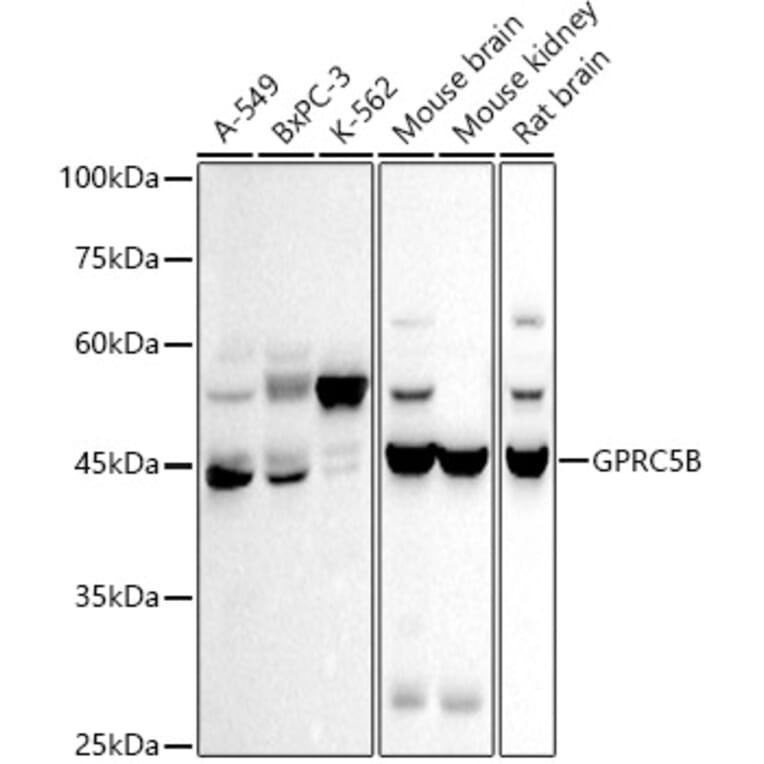 Western Blot - Anti-GPCR GPRC5B Antibody [ARC2932] (A308955) - Antibodies.com