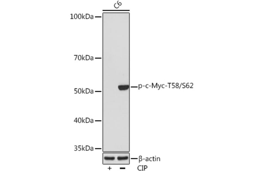 Western Blot - Anti-c-Myc (phospho Thr58 + Ser62) Antibody [ARC1532] (A308956) - Antibodies.com