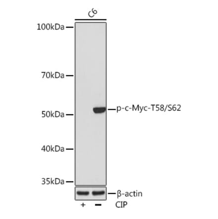Western Blot - Anti-c-Myc (phospho Thr58 + Ser62) Antibody (A308956) - Antibodies.com