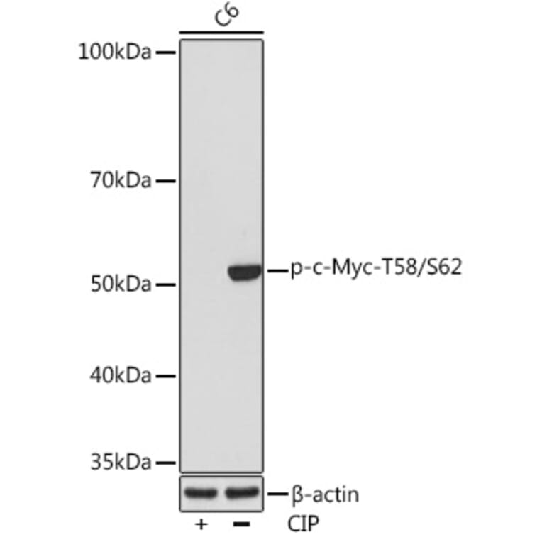 Western Blot - Anti-c-Myc (phospho Thr58 + Ser62) Antibody [ARC1532] (A308956) - Antibodies.com