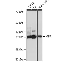 Western Blot - Anti-MFF Antibody [ARC1243] (A308957) - Antibodies.com