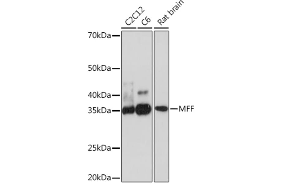 Western Blot - Anti-MFF Antibody [ARC1243] (A308957) - Antibodies.com
