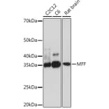 Western Blot - Anti-MFF Antibody [ARC1243] (A308957) - Antibodies.com