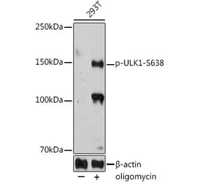 Western Blot - Anti-ULK1 (phospho Ser638) Antibody (A308958) - Antibodies.com