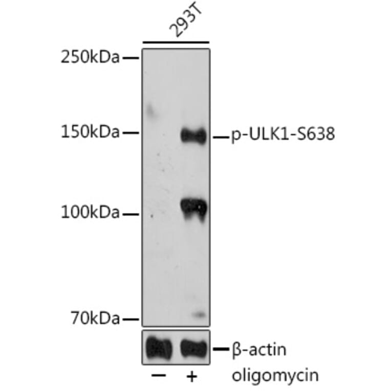 Western Blot - Anti-ULK1 (phospho Ser638) Antibody (A308958) - Antibodies.com