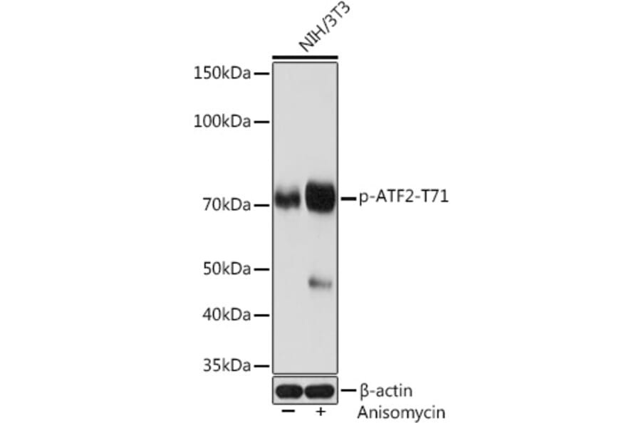 Western Blot - Anti-ATF2 (phospho Thr71) Antibody [ARC1598] (A308959) - Antibodies.com