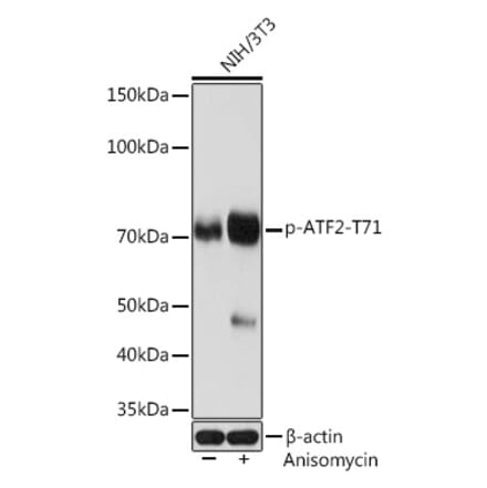 Western Blot - Anti-ATF2 (phospho Thr71) Antibody [ARC1598] (A308959) - Antibodies.com
