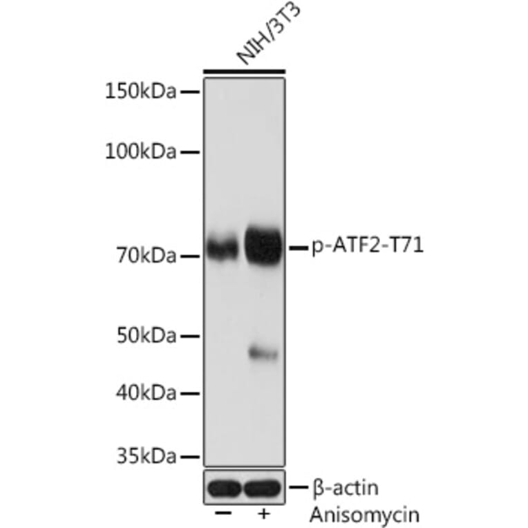 Western Blot - Anti-ATF2 (phospho Thr71) Antibody [ARC1598] (A308959) - Antibodies.com