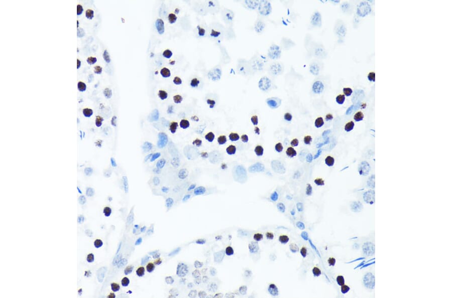 Immunohistochemistry - Anti-Histone H2A.X (phospho Ser139) Antibody [ARC0110] (A308961) - Antibodies.com