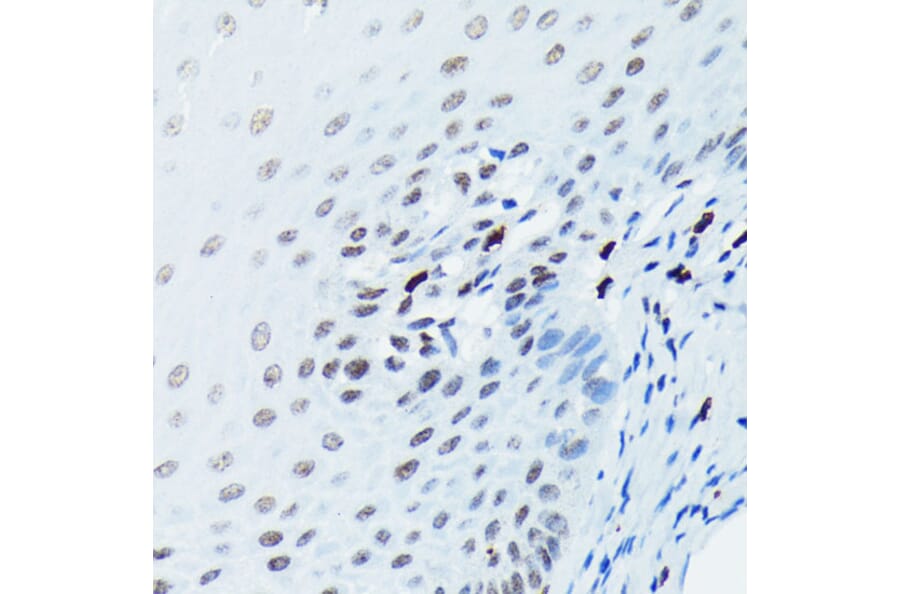 Immunohistochemistry - Anti-Histone H2A.X (phospho Ser139) Antibody [ARC0110] (A308961) - Antibodies.com
