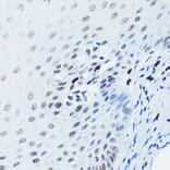 Immunohistochemistry - Anti-Histone H2A.X (phospho Ser139) Antibody [ARC0110] (A308961) - Antibodies.com