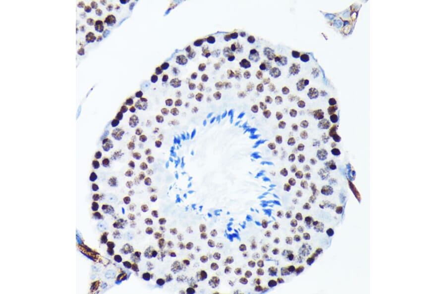 Immunohistochemistry - Anti-Histone H2A.X (phospho Ser139) Antibody [ARC0110] (A308961) - Antibodies.com