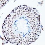 Immunohistochemistry - Anti-Histone H2A.X (phospho Ser139) Antibody [ARC0110] (A308961) - Antibodies.com