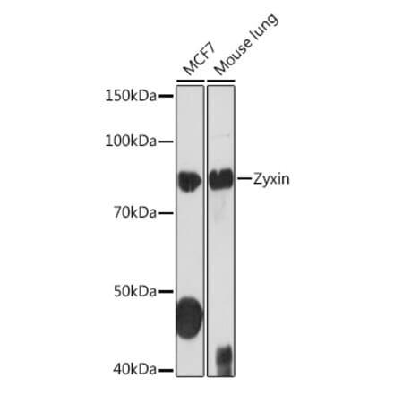 Western Blot - Anti-Zyxin Antibody [ARC1906] (A308962) - Antibodies.com