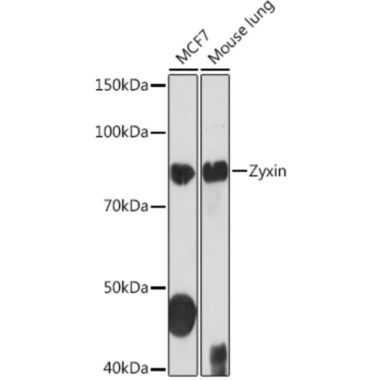 Western Blot - Anti-Zyxin Antibody [ARC1906] (A308962) - Antibodies.com