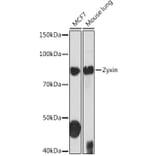 Western Blot - Anti-Zyxin Antibody [ARC1906] (A308962) - Antibodies.com