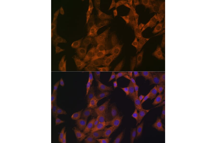 Immunofluorescence - Anti-Zyxin Antibody [ARC1906] (A308962) - Antibodies.com