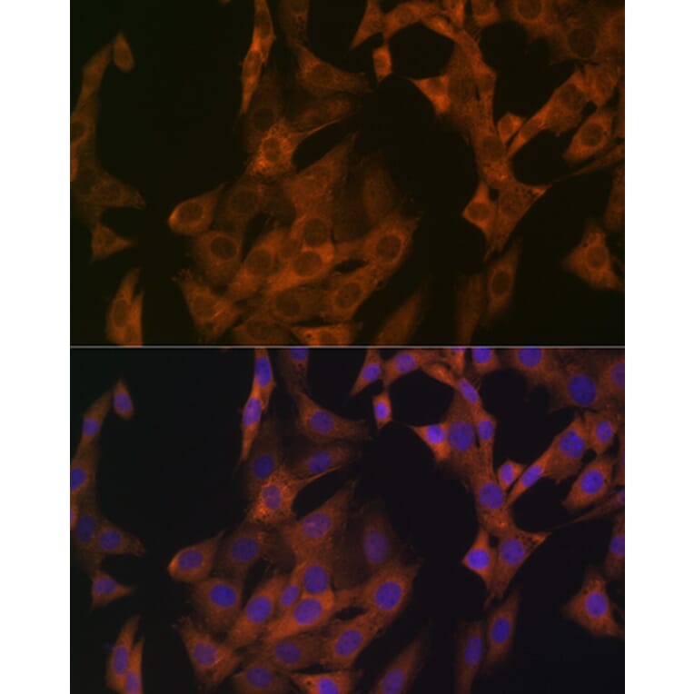 Immunofluorescence - Anti-Zyxin Antibody [ARC1906] (A308962) - Antibodies.com