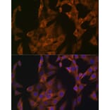 Immunofluorescence - Anti-Zyxin Antibody [ARC1906] (A308962) - Antibodies.com