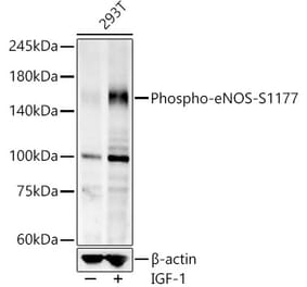 Western Blot - Anti-eNOS (phospho Ser1177) Antibody [ARC58017] (A308963) - Antibodies.com