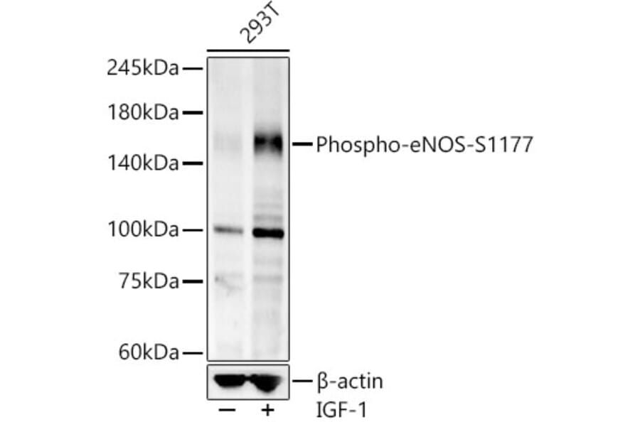 Western Blot - Anti-eNOS (phospho Ser1177) Antibody [ARC58017] (A308963) - Antibodies.com