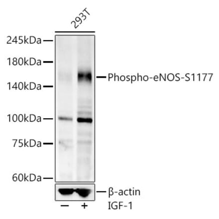 Western Blot - Anti-eNOS (phospho Ser1177) Antibody [ARC58017] (A308963) - Antibodies.com