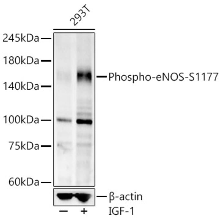 Western Blot - Anti-eNOS (phospho Ser1177) Antibody [ARC58017] (A308963) - Antibodies.com