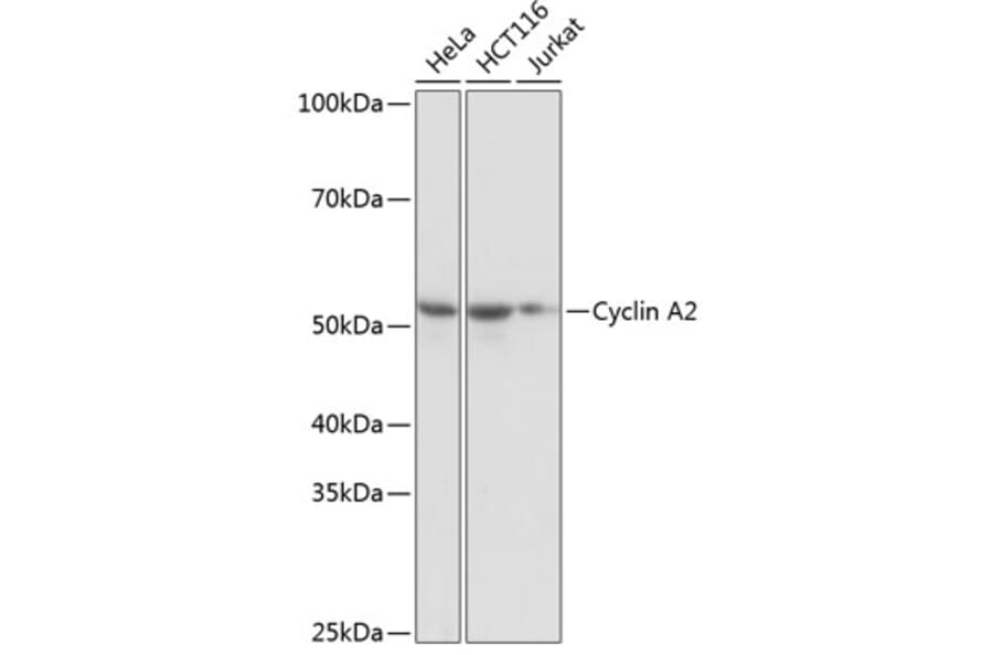 Western Blot - Anti-Cyclin A2 Antibody [ARC0359] (A308964) - Antibodies.com