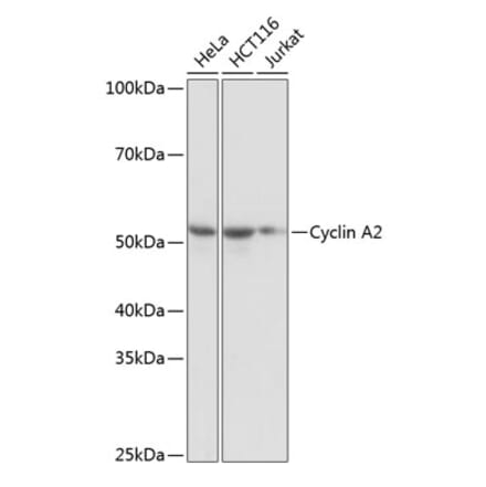 Western Blot - Anti-Cyclin A2 Antibody [ARC0359] (A308964) - Antibodies.com