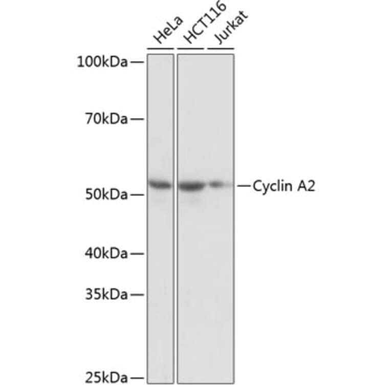 Western Blot - Anti-Cyclin A2 Antibody [ARC0359] (A308964) - Antibodies.com