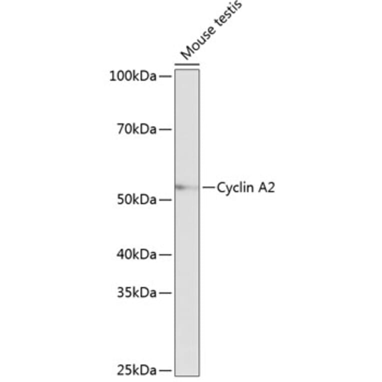 Western Blot - Anti-Cyclin A2 Antibody [ARC0359] (A308964) - Antibodies.com