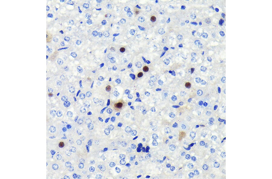 Immunohistochemistry - Anti-Cyclin A2 Antibody [ARC0359] (A308964) - Antibodies.com