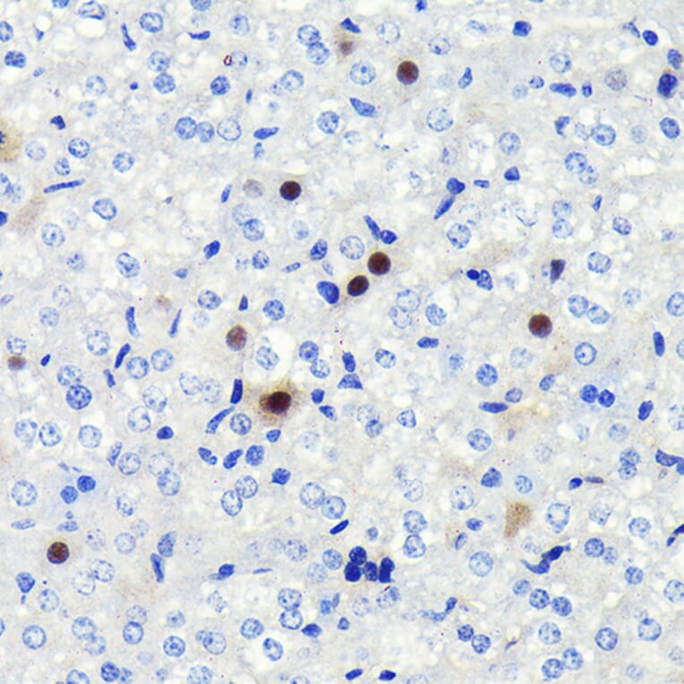 Immunohistochemistry - Anti-Cyclin A2 Antibody [ARC0359] (A308964) - Antibodies.com