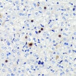 Immunohistochemistry - Anti-Cyclin A2 Antibody [ARC0359] (A308964) - Antibodies.com