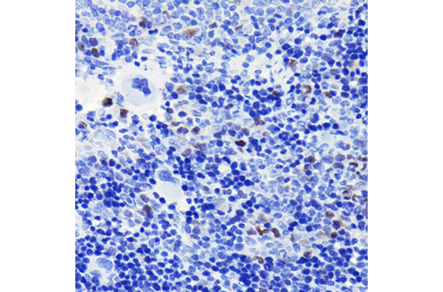 Immunohistochemistry - Anti-Cyclin A2 Antibody [ARC0359] (A308964) - Antibodies.com