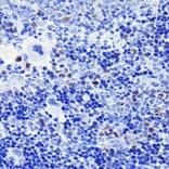 Immunohistochemistry - Anti-Cyclin A2 Antibody [ARC0359] (A308964) - Antibodies.com